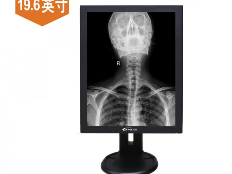 DR数字成像/CT/核磁共振专用2M灰阶诊断显示器