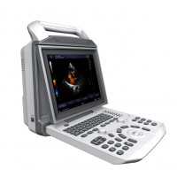 中旗ZONCARE-V7便携式彩色多普勒超声诊断系统