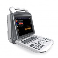 中旗ZONCARE-V6便携式彩色多普勒超声诊断系统